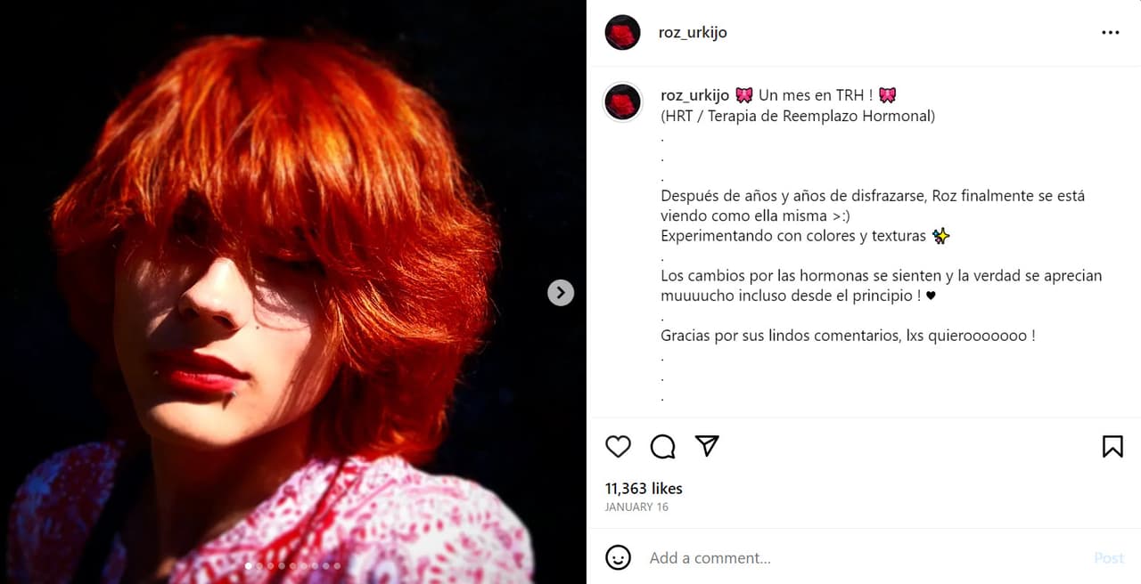 Roz Urkijo se sometió a "terapia hormonal".