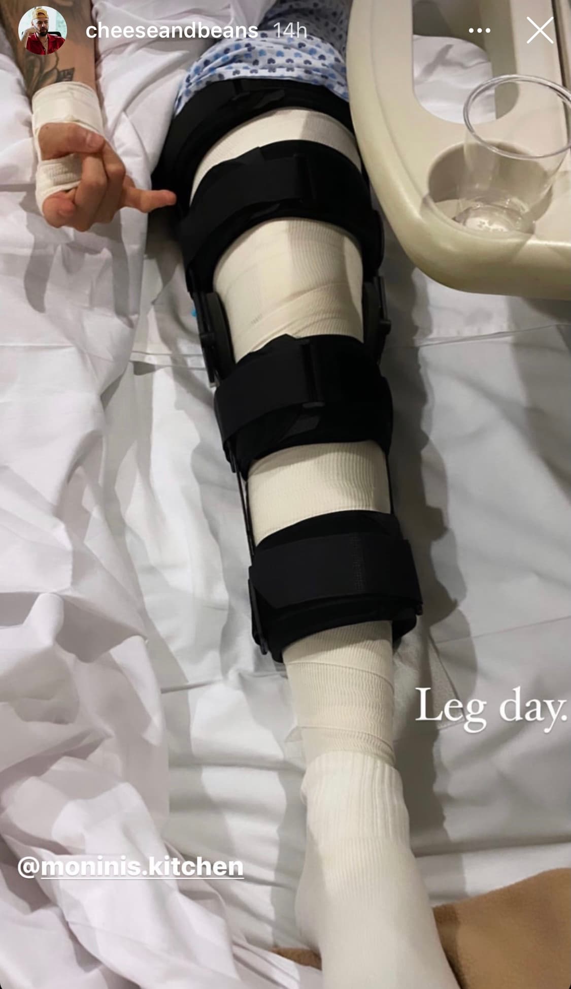 Jesse Huerta se encuentra recuperándose del accidente que sufrió
