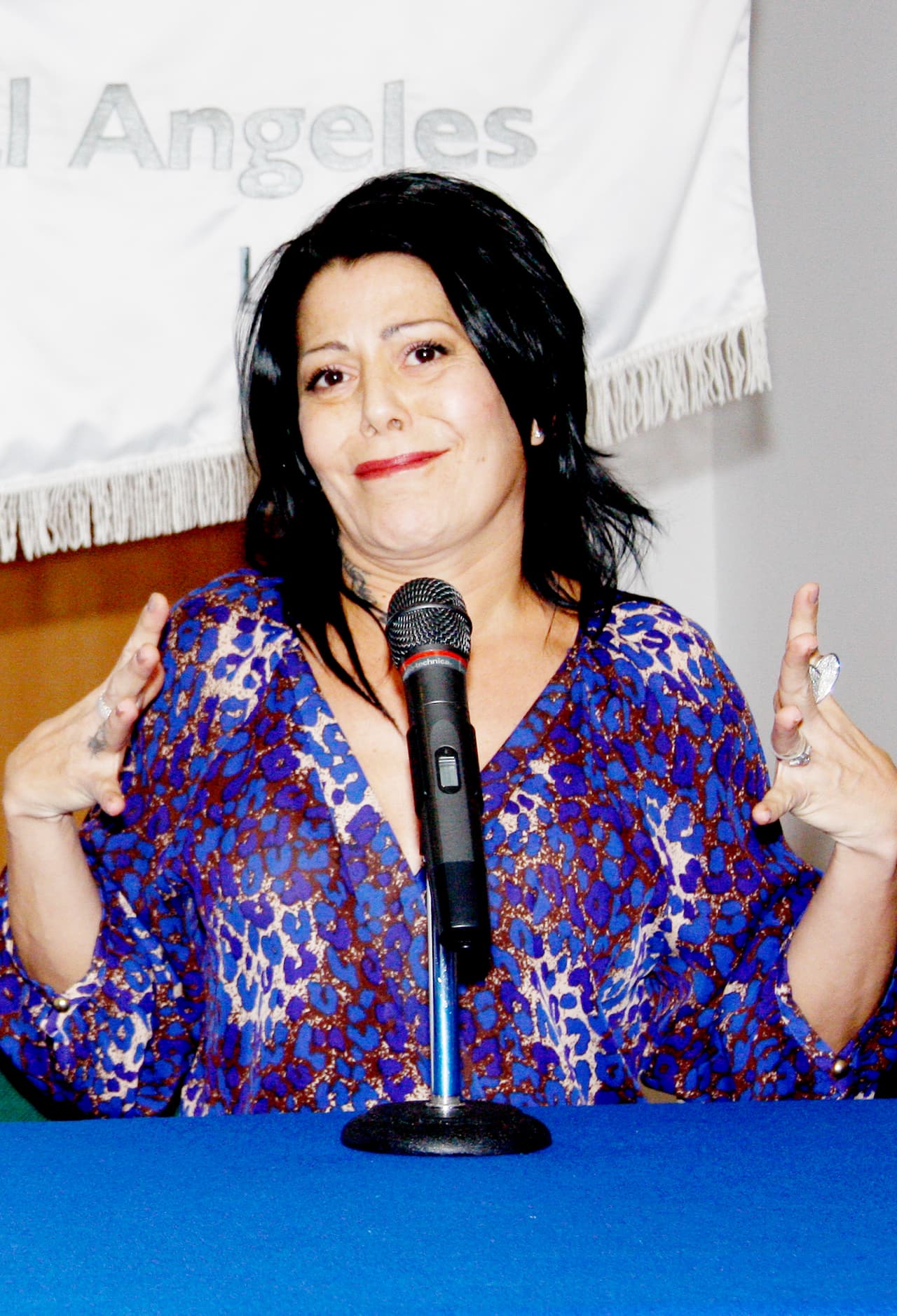 La intérprete tuvo una cirugía de cadera para colocarle una prótesis en enero de 2013. Un año después reveló en uno de sus conciertos que se había sometido a su cirugía #19, asegurando que a pesar de haber sido un año muy difícil, agradeció estar con vida.