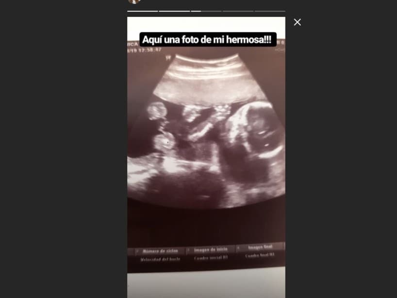 A mediados de agosto, la actriz compartió, a través de una historia en su cuenta de Instagram, una imagen de su ultrasonido, la cual acompañó con la frase: “aquí una foto de mi hermosa”.