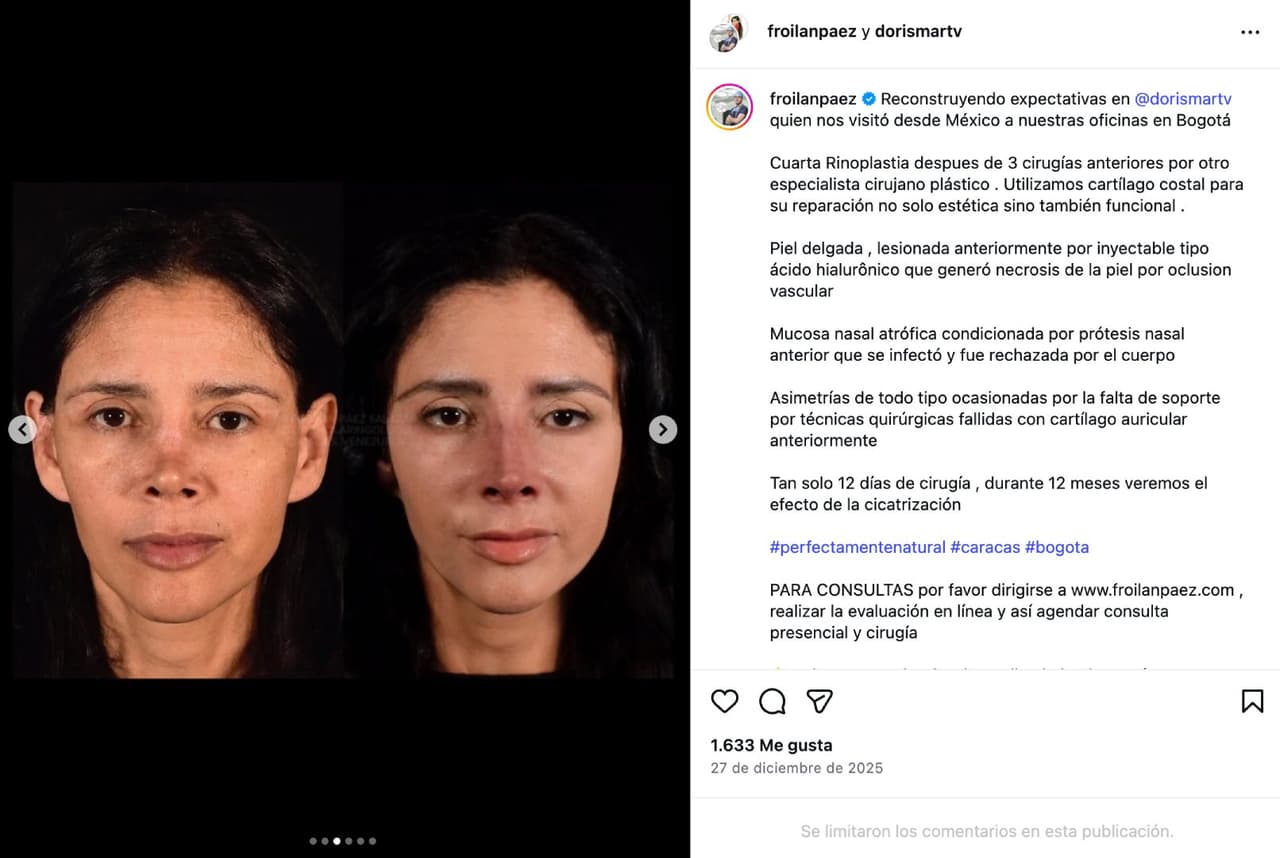 Dorismar, cirugías.