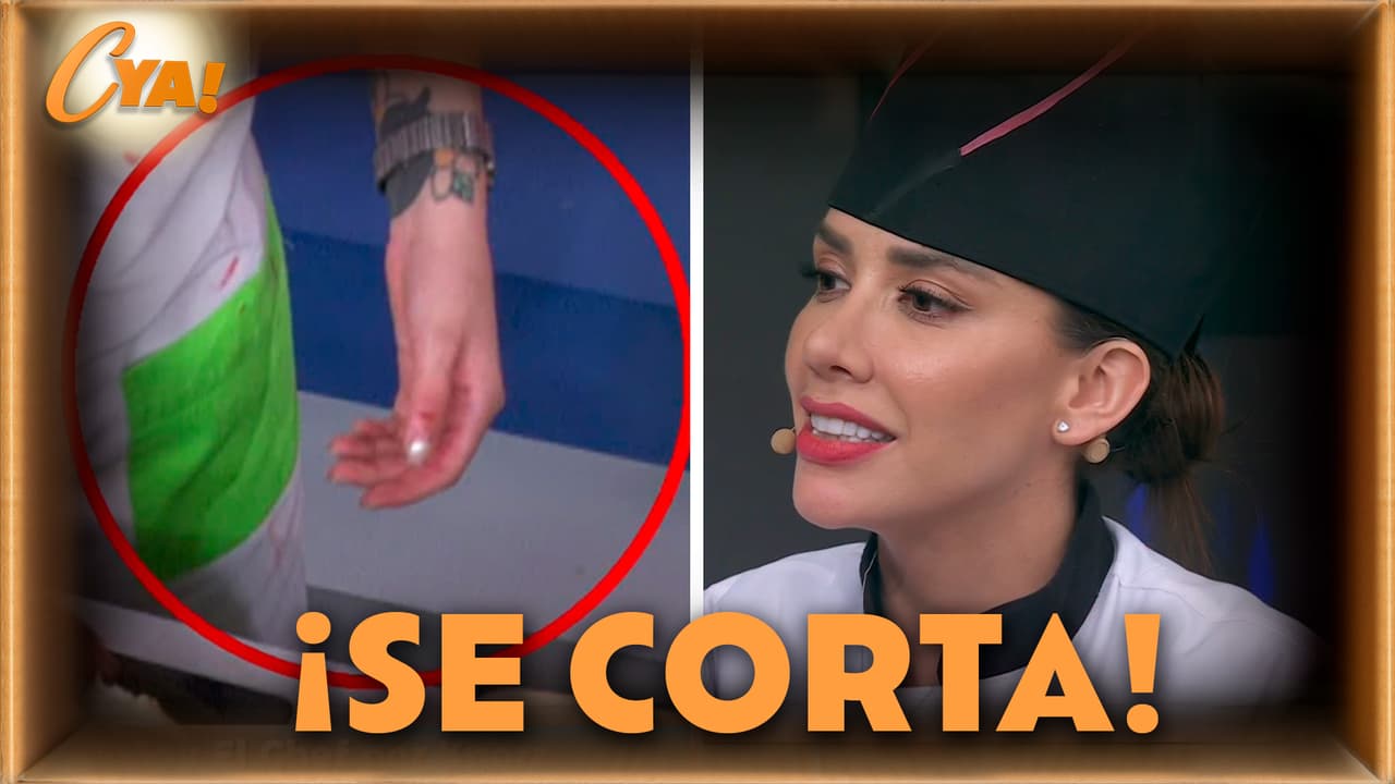 Karime Pindter sufrió un accidente en la cocina de Hoy soy el Chef