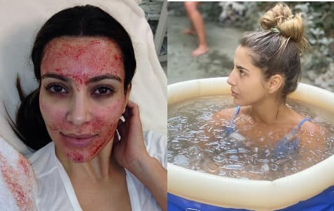 Los tratamientos de belleza más extravagantes de las famosas