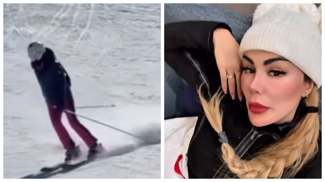 Ninel Conde no puede caminar por fuerte accidente en la nieve, este es su estado de salud