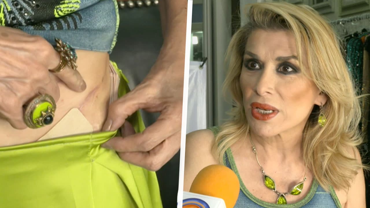Dulce relata el calvario que sufrió por el tumor que le detectaron en un riñón