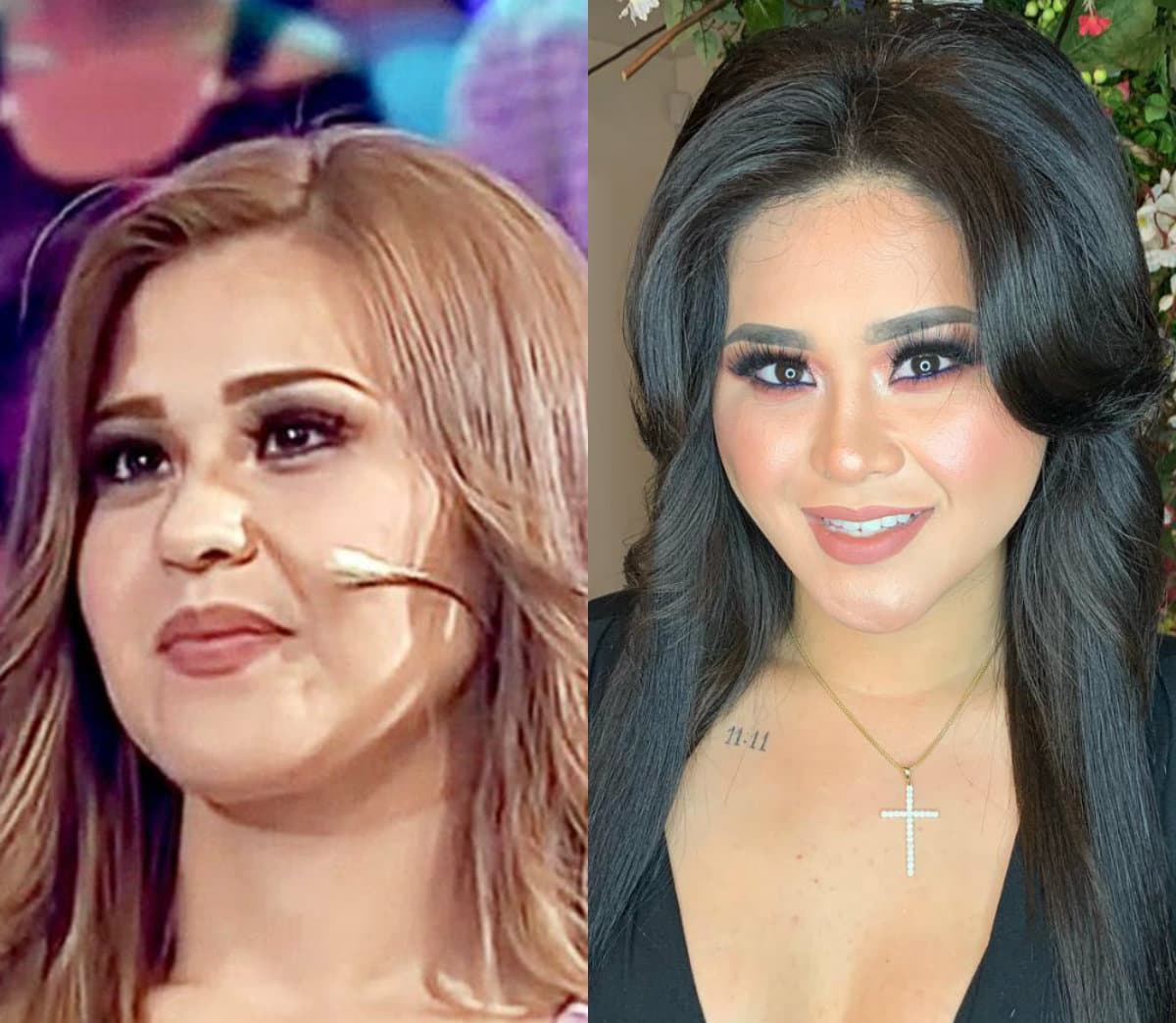 Además se ha realizado tres liposucciones, siempre con el apoyo de su familia. “Me hice lipo, me hice una aplicación fabulosa que te acinturan, te amarran músculos junto con la lipo y lipo en pierna”, señaló.