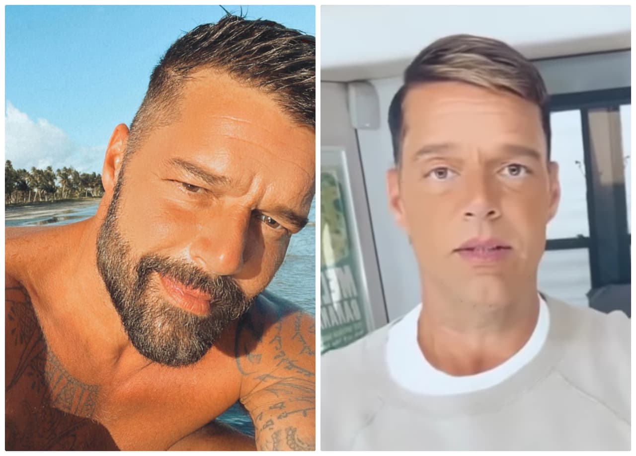Ricky Martin aparece con drástica transformación en rostro; así se ve