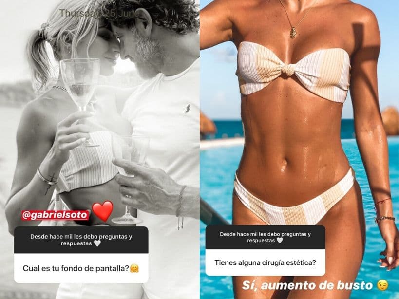 Irina Baeva confiesa desde su cirugía plástica hasta su amor por Gabriel Soto