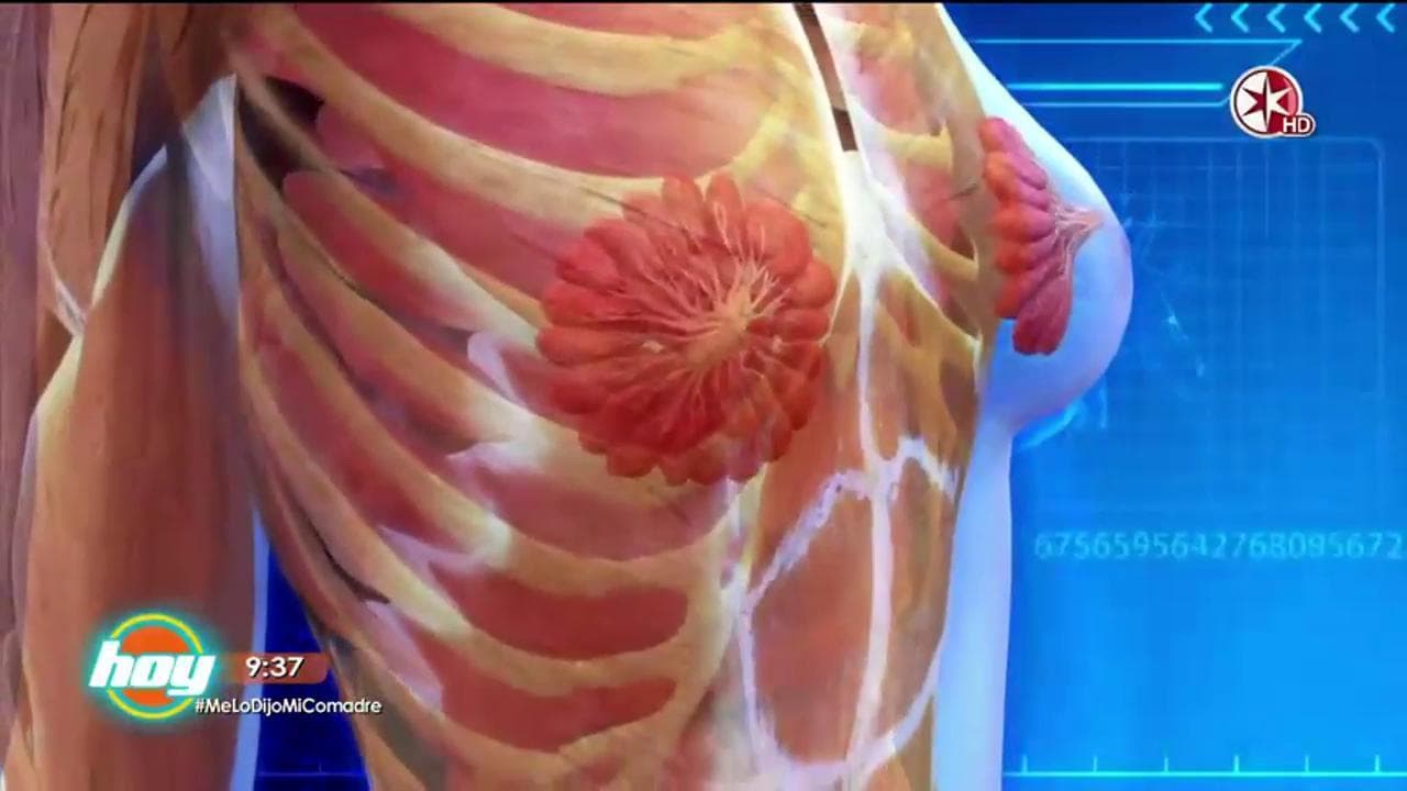 Entérate qué alimentos te ayudarán a prevenir el cáncer de mama