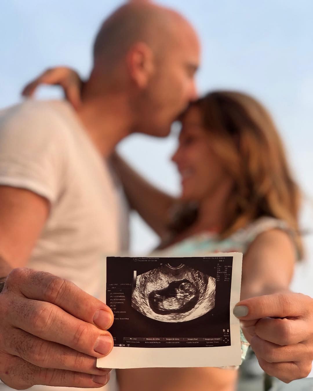 “No puedo más que agradecer a Dios y a la vida por tener el privilegio de vivir las sensaciones que hoy me llenan el corazón. Preparo mi mente y mi cuerpo para pronto recibir a este bebé que nos eligió para ser sus papás”, escribió la cantante en Instagram.