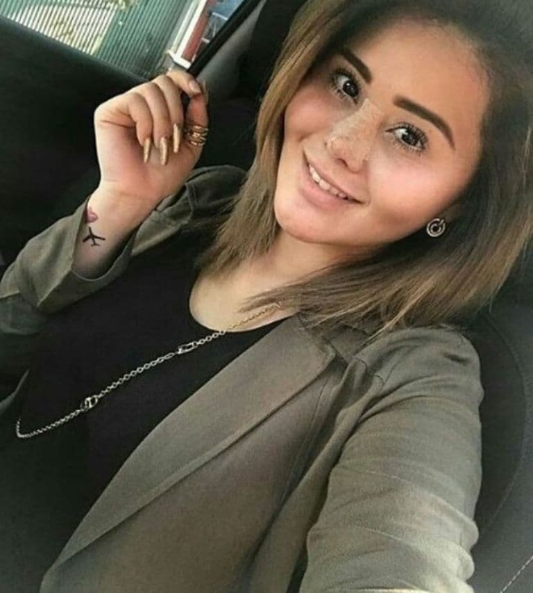 Se realizó una rinoplastia