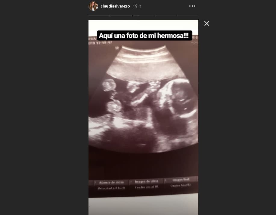 Claudia Álvarez dejó ver a su hija en su último ultrasonido