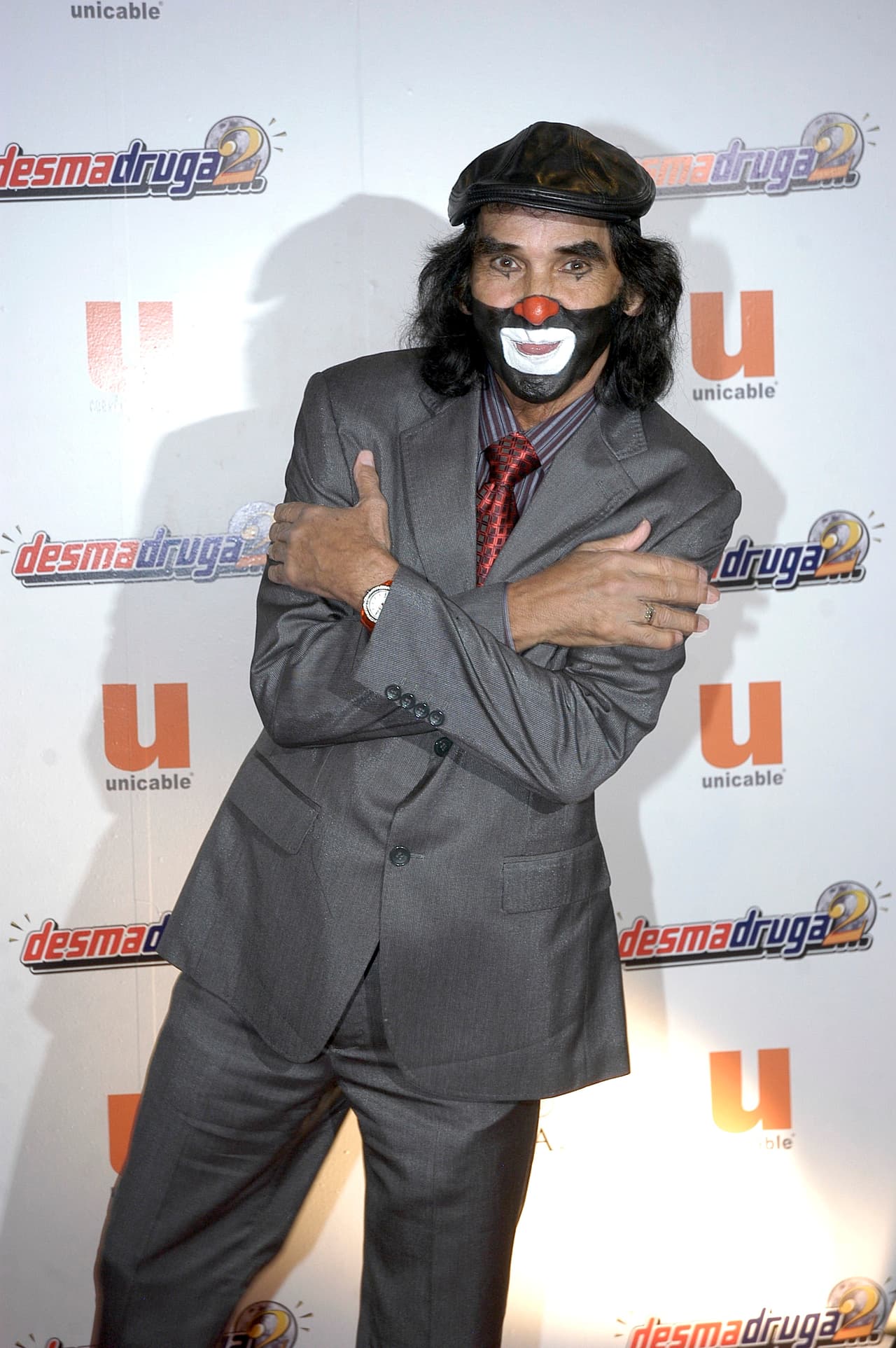 Cepillín es intubado tras ingresar a terapia intensiva y presentar neumonía e insuficiencia cardíaca