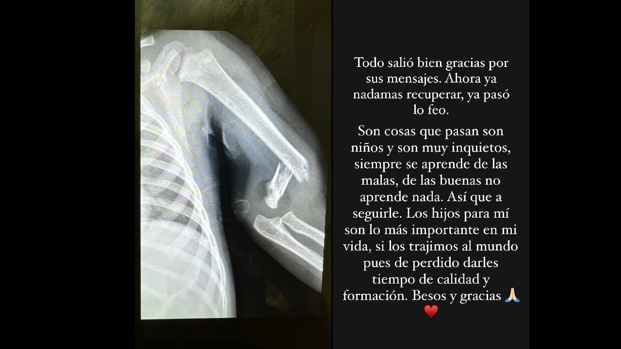 Poncho De Nigris revela cómo está su hijo tras cirugía por accidente