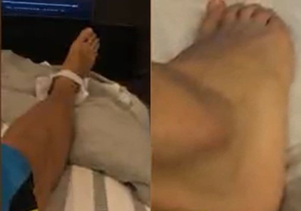 David Zepeda muestra fotos de su accidente