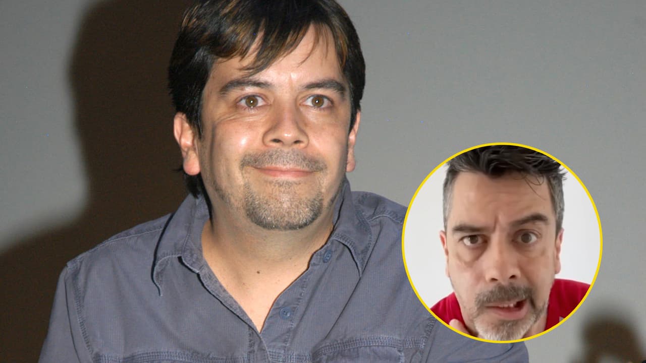 Carlos Espejel aparece con parálisis facial por estrés, esto se sabe