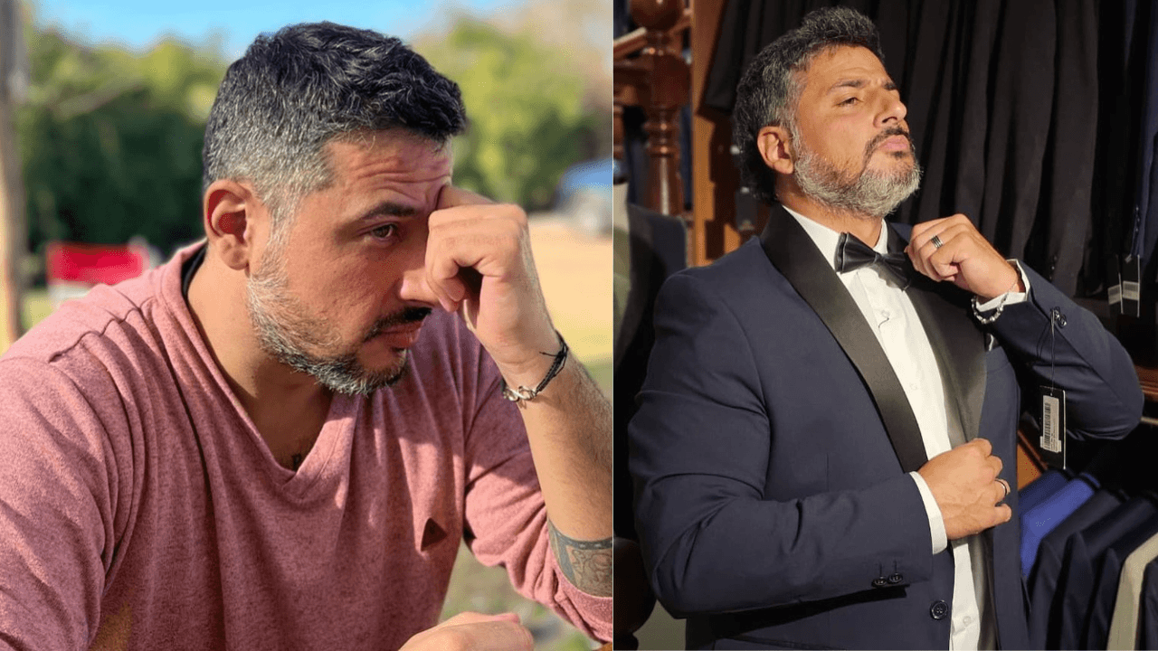 Querido actor de telenovelas pierde un ojo: casi en lágrimas, revela brutales detalles del fuerte accidente