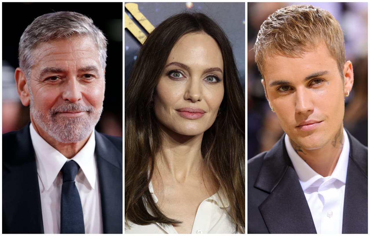 Justin Bieber y otras celebridades que han padecido parálisis facial