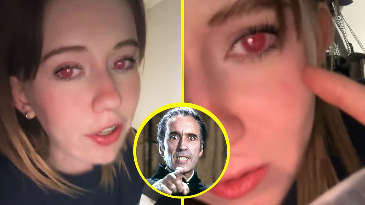 ¿Es vampira? Mujer causa impacto en TikTok por tener ojos rojos: la verdad científica detrás