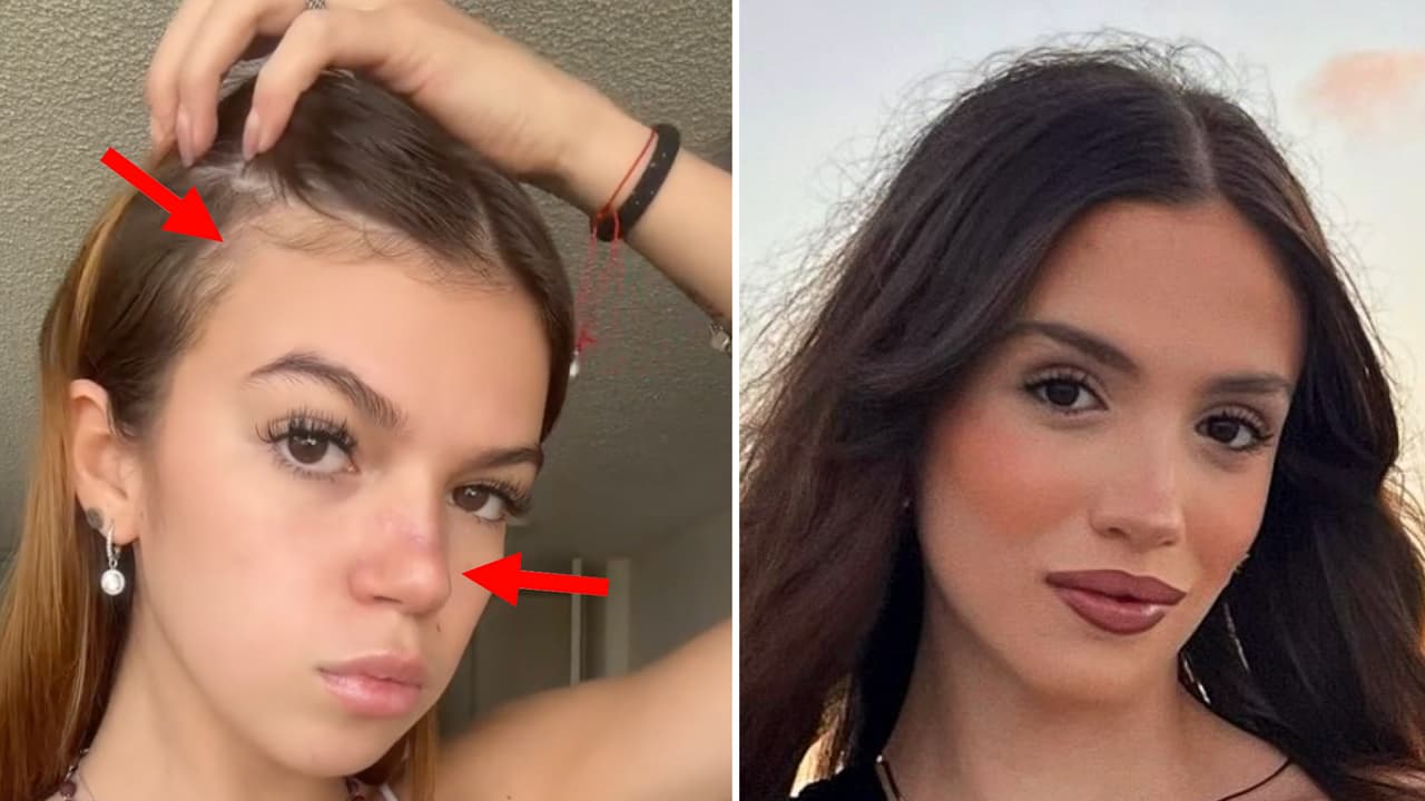 Valentina Gilabert muestra las cicatrices de las 14 heridas que la mantuvieron al borde de la muerte