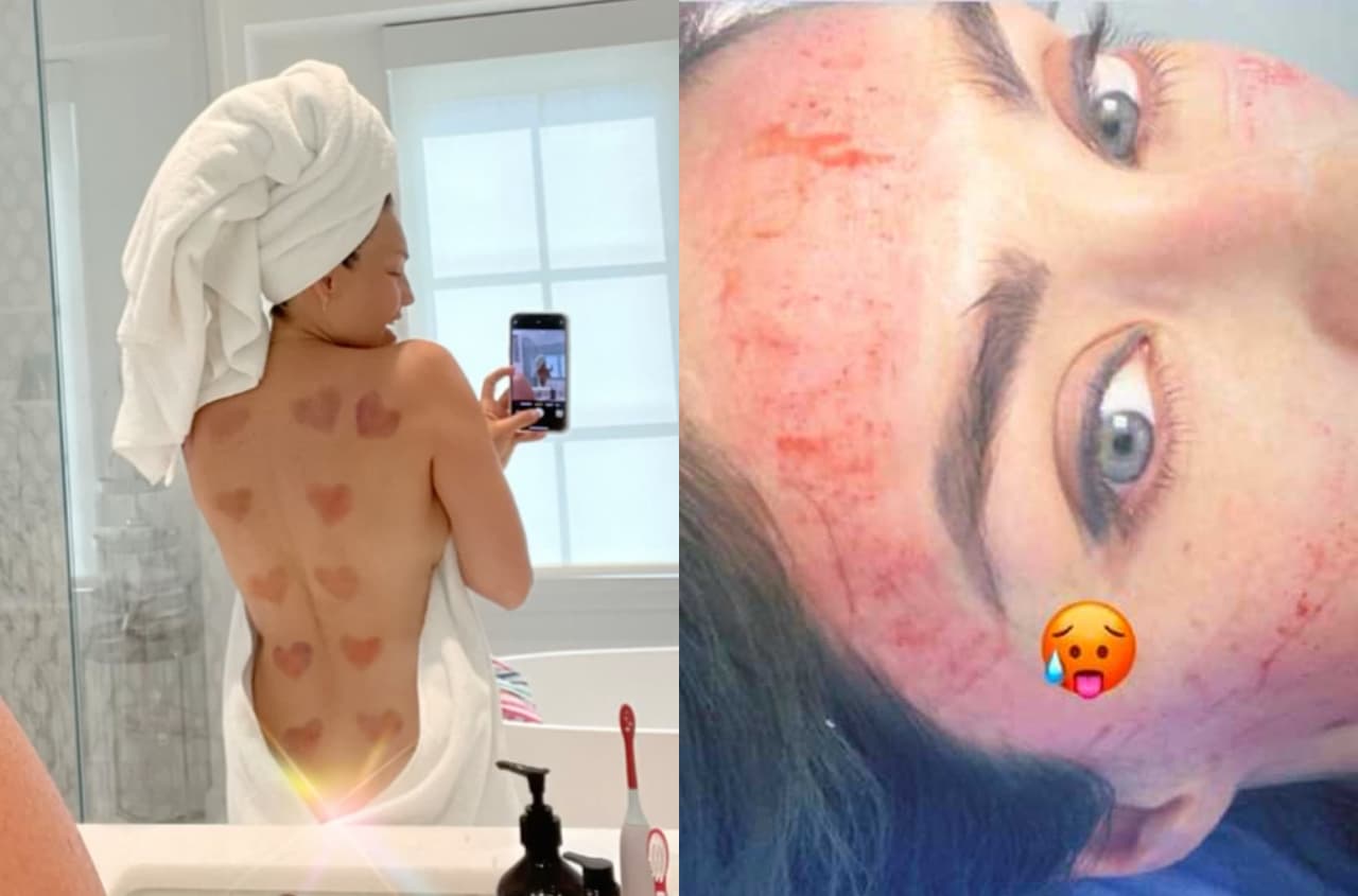 Los 7 tratamientos de belleza más exóticos de las famosas