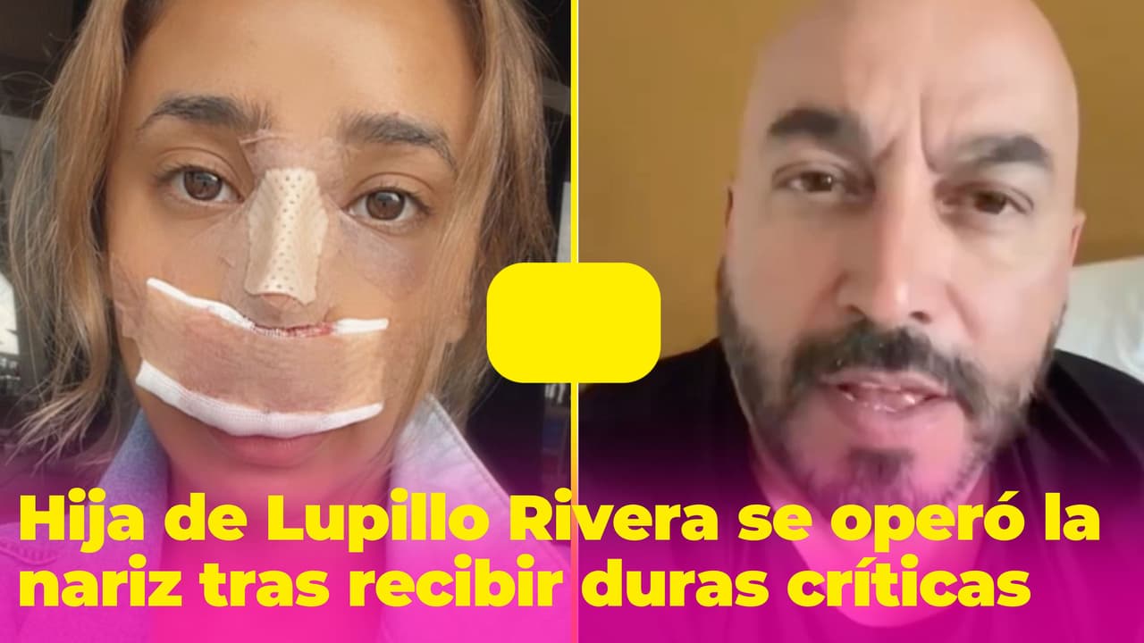 La hija de Lupillo Rivera se hizo la rinoplastia porque “se burlaban” de su nariz