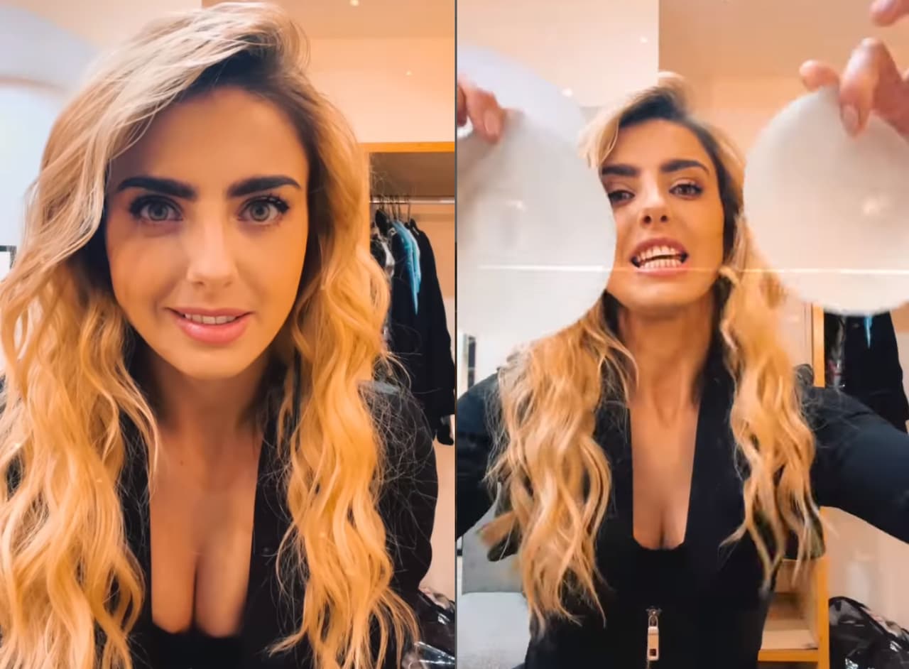 Michelle Renaud habla de su relación más tóxica: los implantes