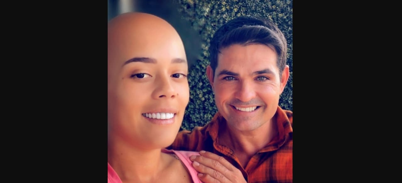 En la imagen, Brenda Kellerman aparece sin un solo cabello, pero para tranquilidad de sus fans el cambio se logró por un filtro. “¿Que le pasó a tu cabello? Negrita. Mi pelona”, indicó el actor.
