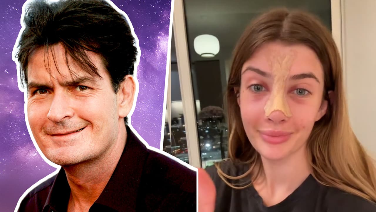 La hija de Charlie Sheen se operó la nariz para no parecerse a él: recibía burlas