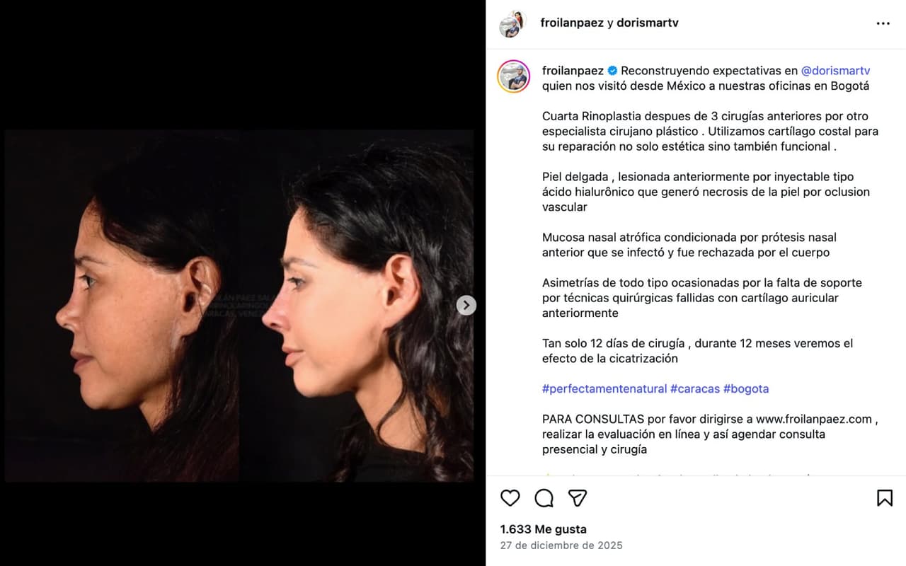 Dorismar, evolución.