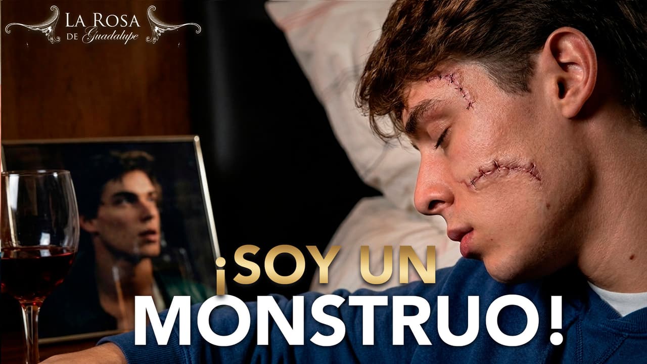 Adán pierde su hermoso rostro tras sufrir un accidente