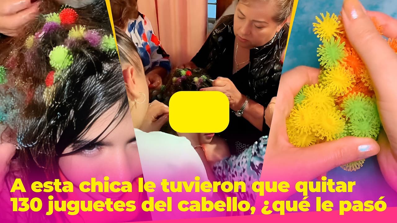 A esta chica le tuvieron que quitar 130 juguetes del cabello: por esta razón son muy peligrosos