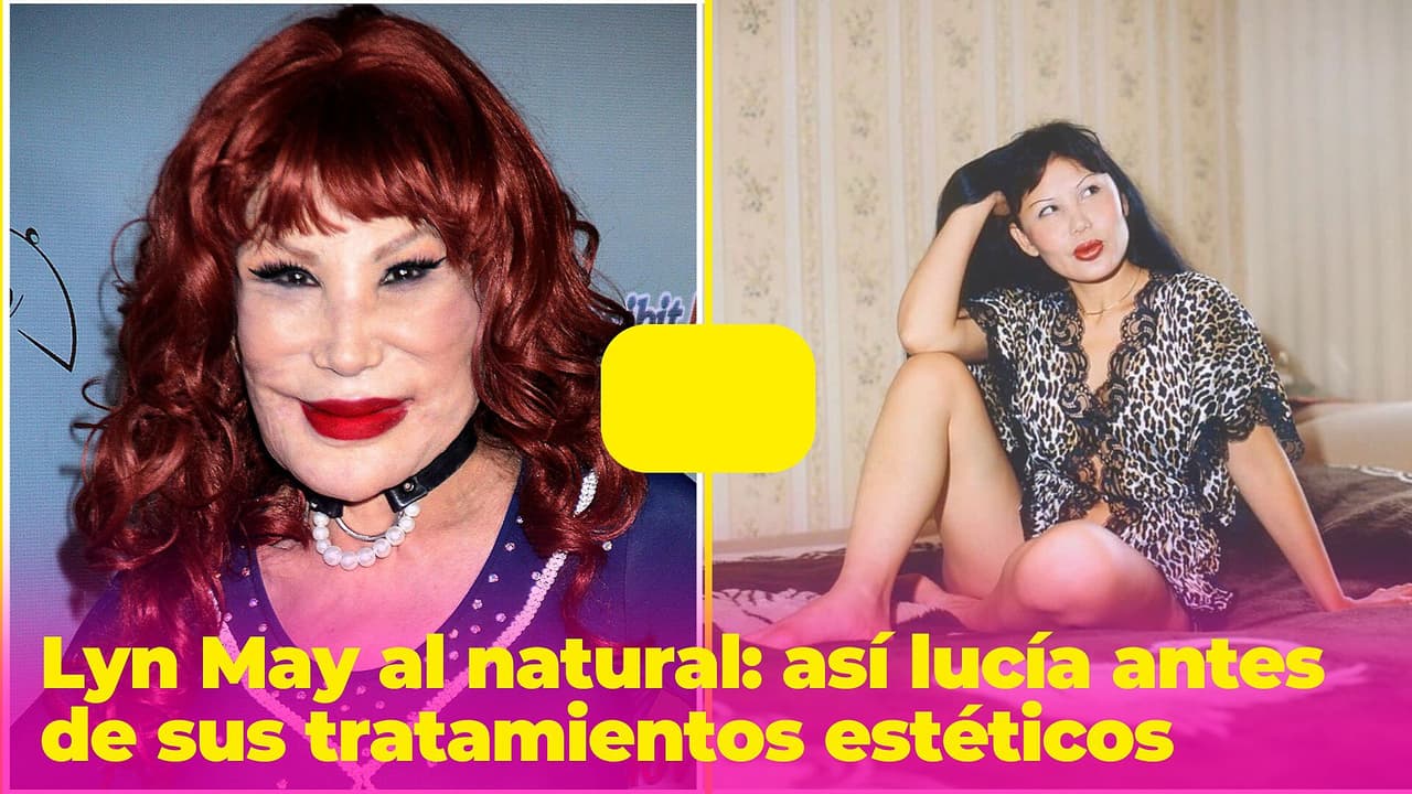 Lyn May al natural: así lucía la vedette antes de sus tratamientos estéticos
