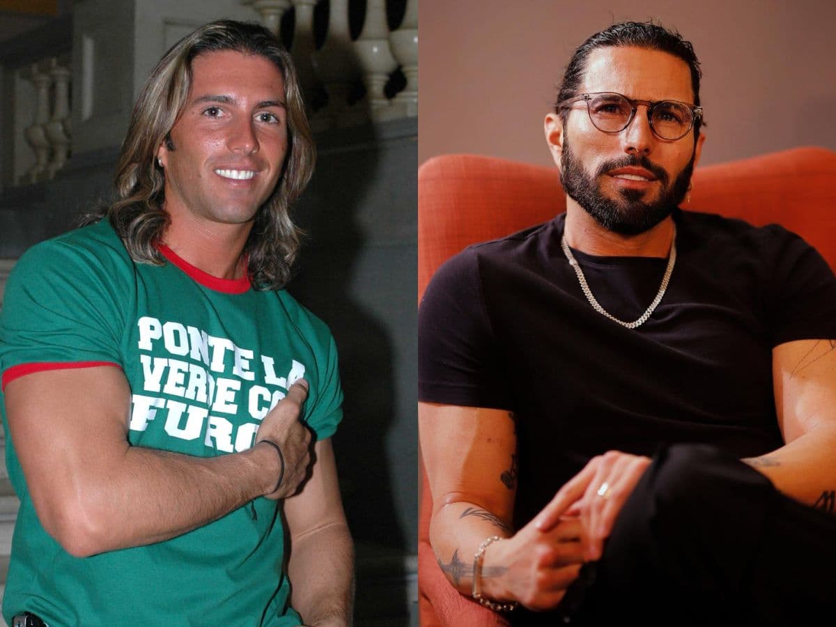 Poncho de Nigris y su transformación: de su cirugía de párpados hasta su injerto de cabello