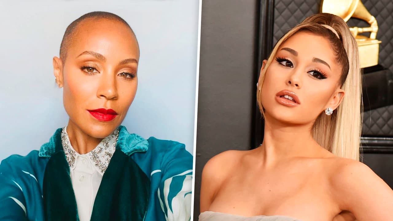 “La alopecia y yo seremos amigas”: estas famosas salieron adelante tras perder su cabello