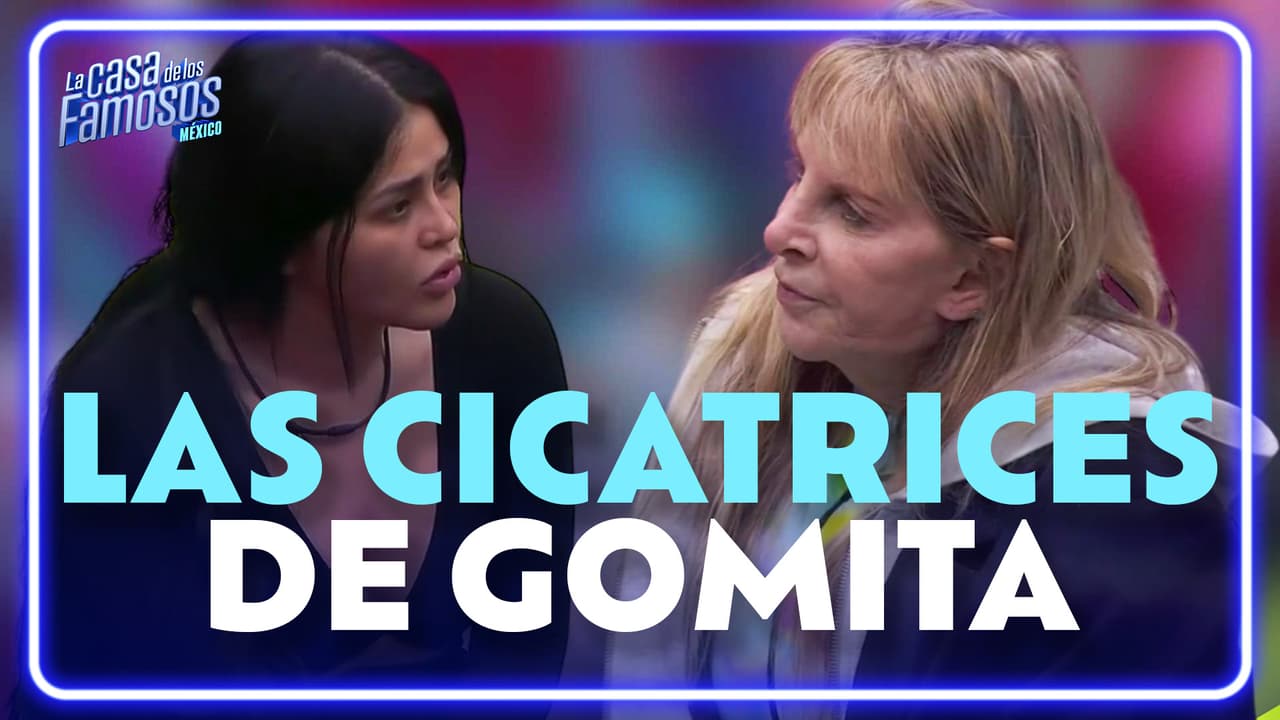 Gomita le muestra a Shanik las cicatrices de su pasado | La Casa de los Famosos