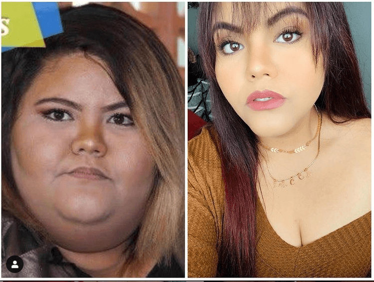 “Más de 80 kilos menos. Mi piel está llena de estrías, cicatrices y demás. Mi piel está suelta, tan suelta que me causa inseguridad. Mi piel es el vivo recordatorio DIARIO de mi pasado, de mi depresión, de mi falta de autoestima y amor propio. Sin embargo, mi piel soy Yo. Cuento mi historia, mis mayores miedos y mis inseguridades”, señaló la joven.