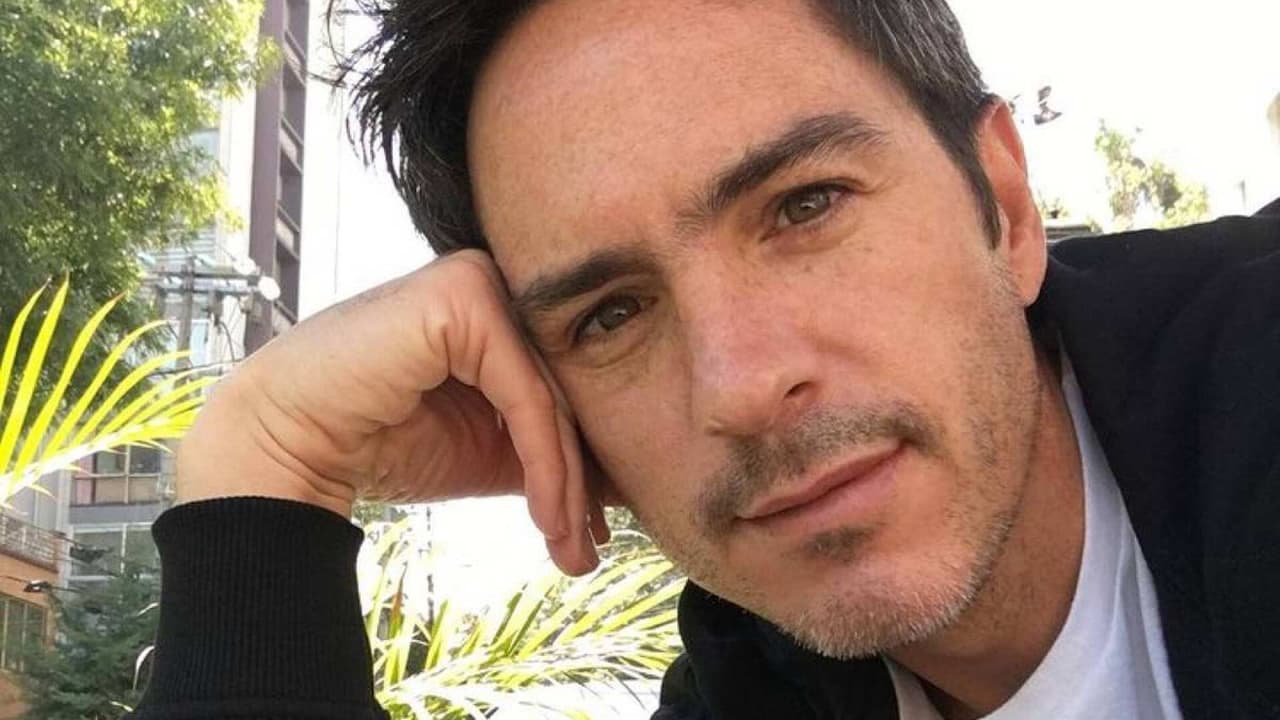 Mauricio Ochmann impresiona al realizarse tratamiento estético y muestra su antes y después