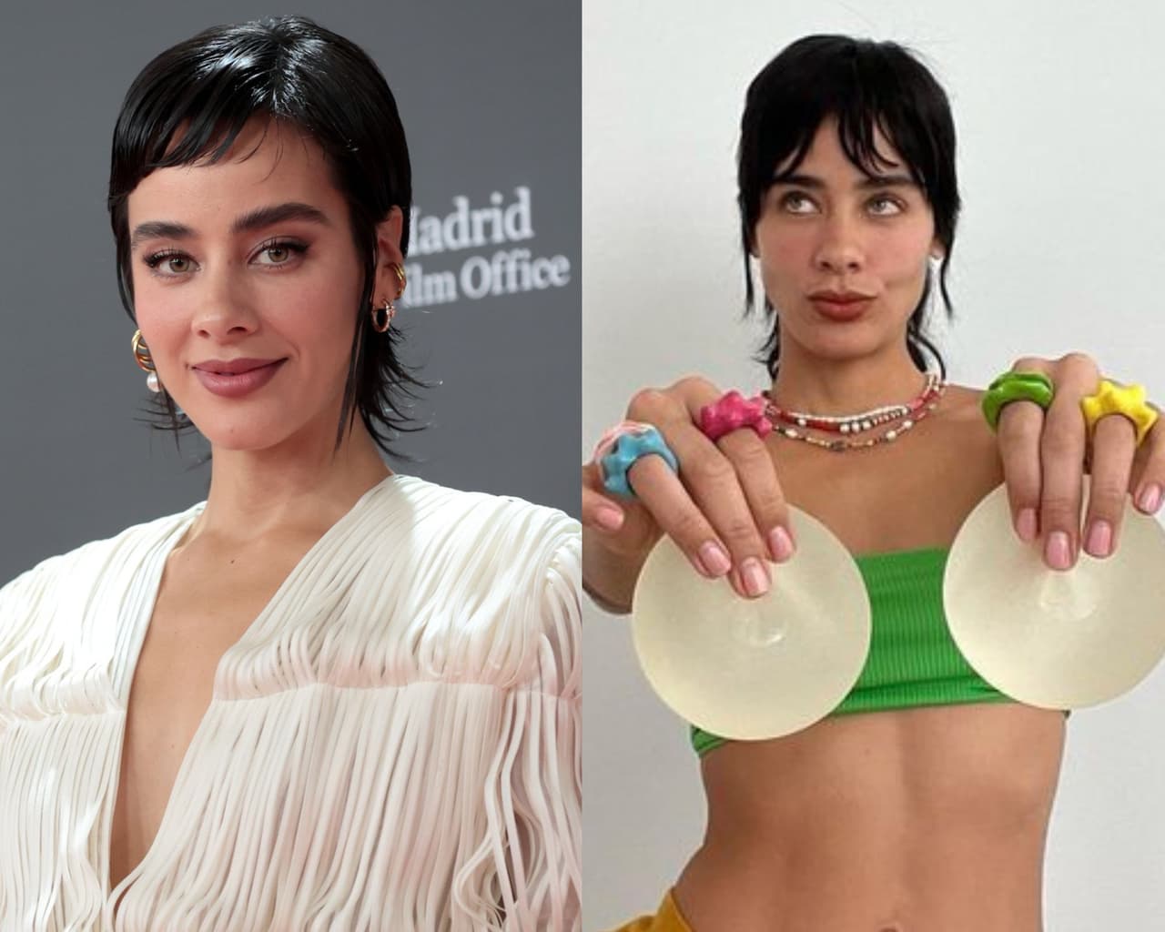 Esmeralda Pimentel, sin filtro, muestra estrías y cicatrices tras retirarse los implantes de seno
