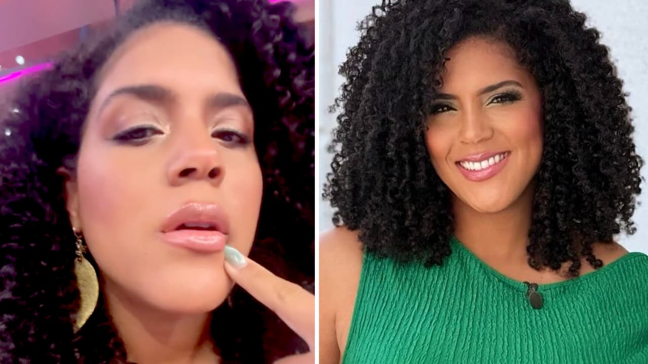 Francisca reconoce que su rostro luce diferente, ¿se inyectó los labios?