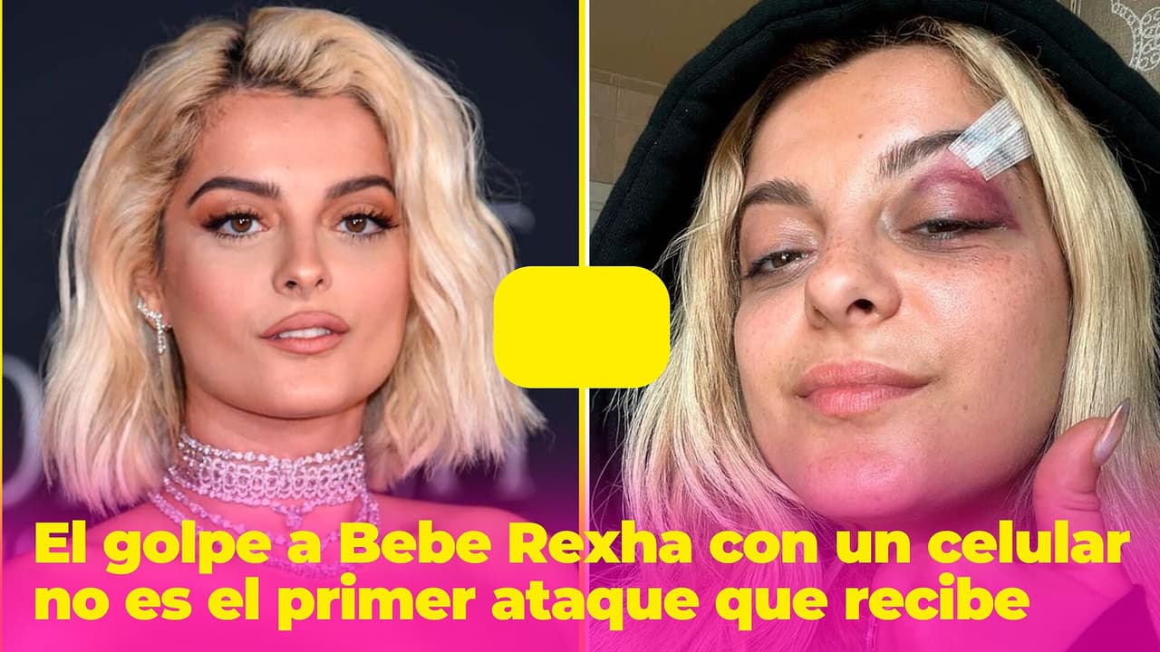 El golpe a Bebe Rexha con un celular no es el primer ataque que recibe: ha soportado varias humillaciones