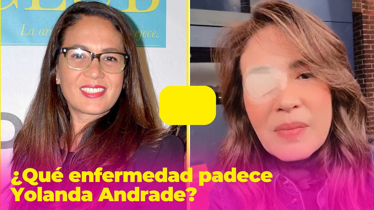 ¿Qué enfermedad padece Yolanda Andrade? El aneurisma en su ojo no fue lo más grave