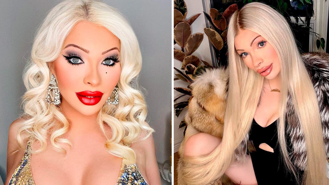 Joven gastó 50 mil dólares en cirugías para parecerse a Marilyn Monroe, pero se arrepintió 