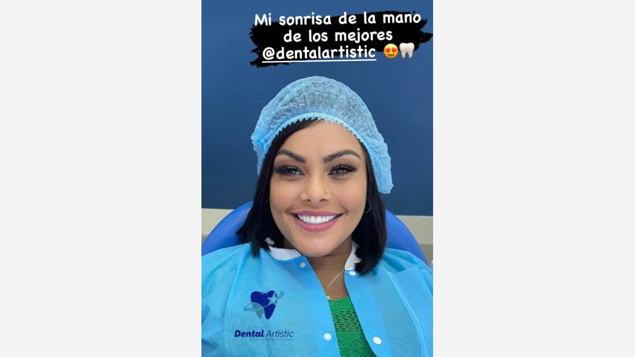Wanda Díaz presume su nueva sonrisa