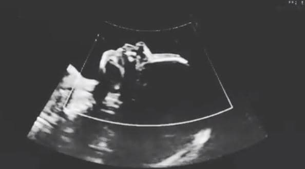 Aunque en su posteo de Instagram, el cual fue acompañado de un ultrasonido, la cantante no abundó en detalles sobre su esposa, sí mencionó que la había conocido hace siete años y posteriormente, indicó que se habían casado.