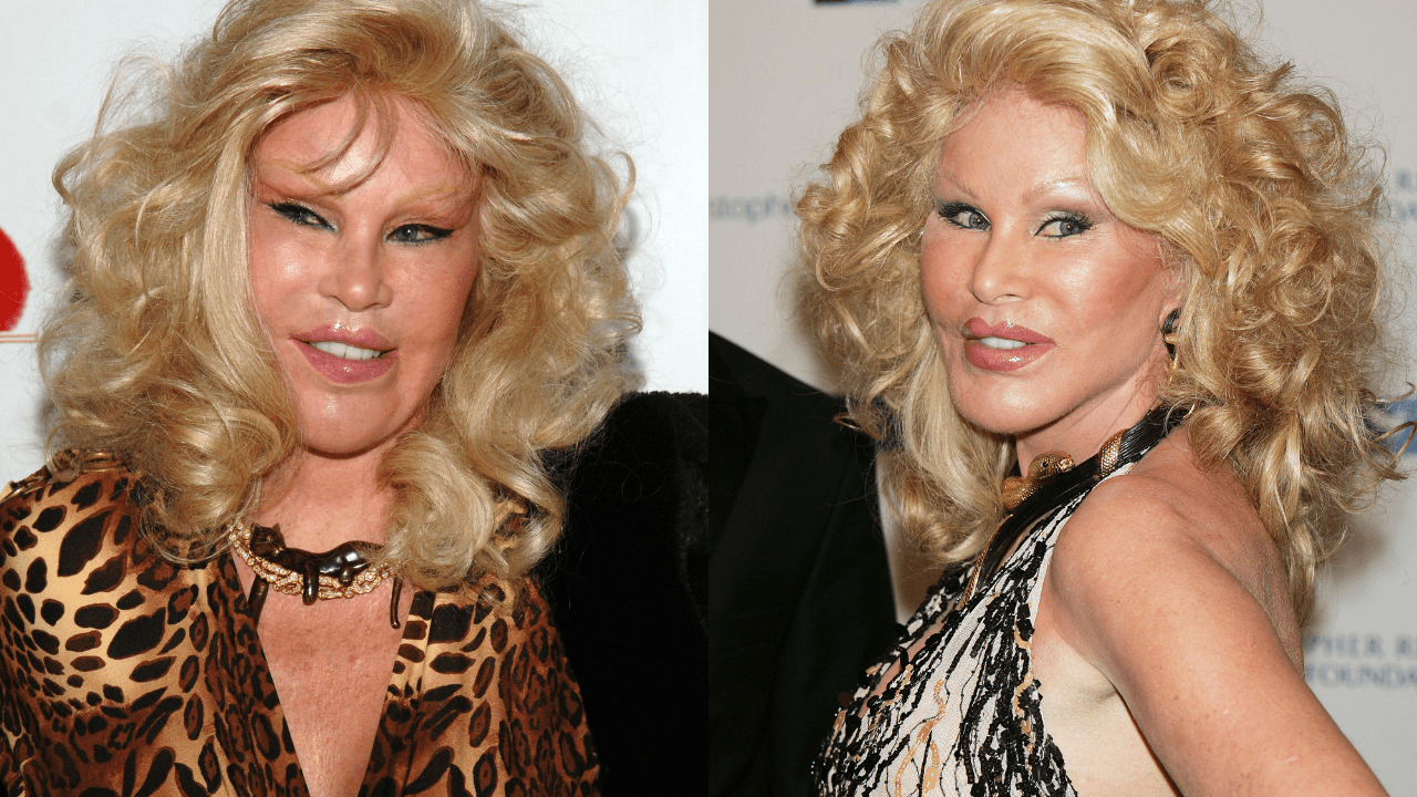 Muere la famosa Jocelyn Wildenstein, conocida como la ‘Mujer gato’: su pareja revela de qué falleció 