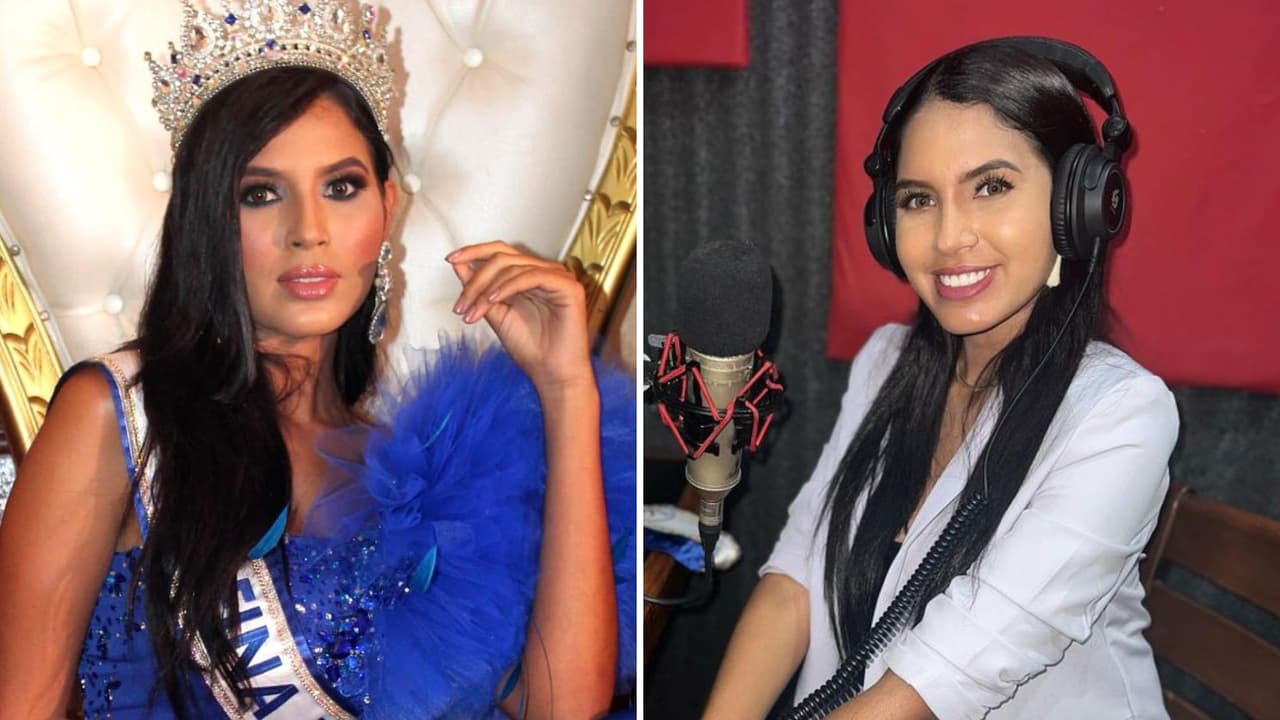 Muere la periodista y modelo Wilevis Brito tras cirugía maxilofacial: tenía 24 años