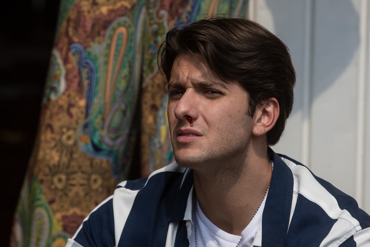 ¡Pobre 'Brandon'! Quedó todo adolorido del golpazo que le propinaron por andar con dos mujeres al mismo tiempo. ¿Seguirá engañándolas? Descúbrelo de lunes a viernes a las 6:30 pm. en "La Mexicana y el Güero".