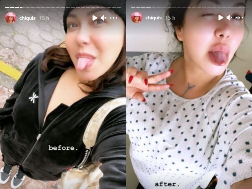 Chiquis Rivera presumió el resultado de su cirugía de senos.