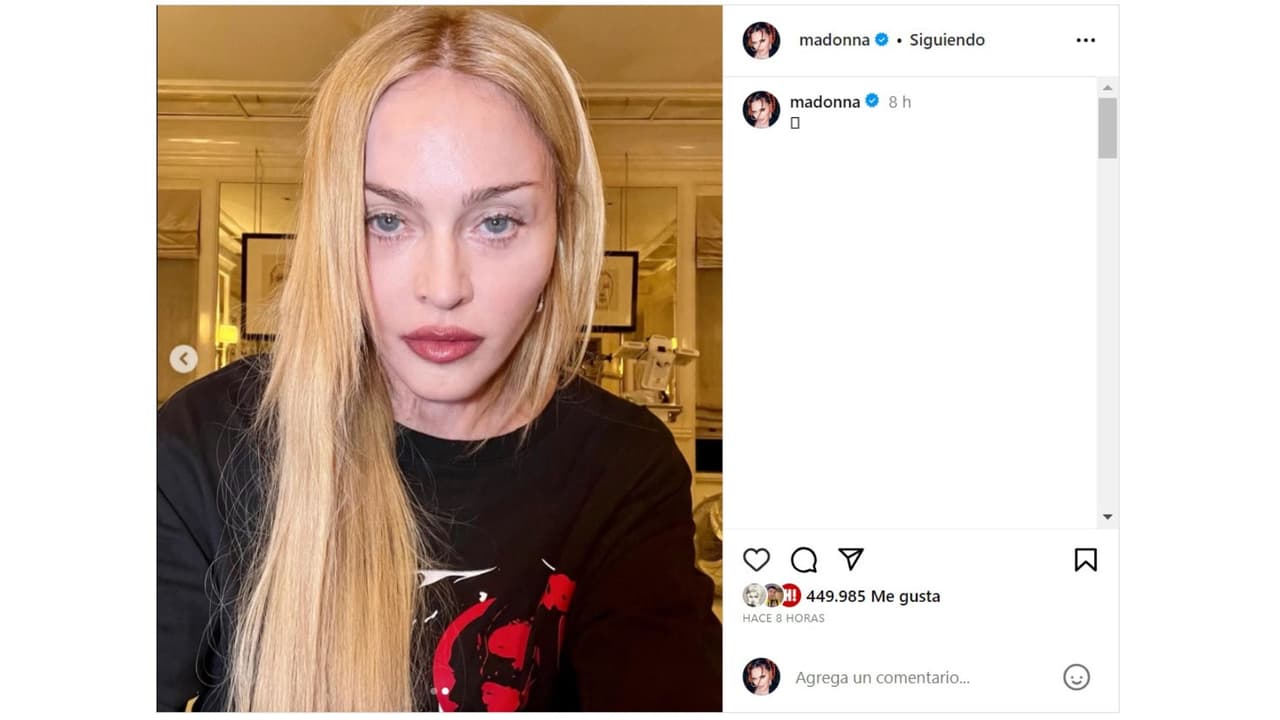 Madonna reapareció en redes sociales en medio de su recuperación.